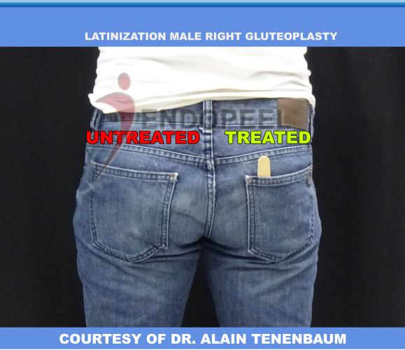result-latinisation-male-R-butt-with-jeans
