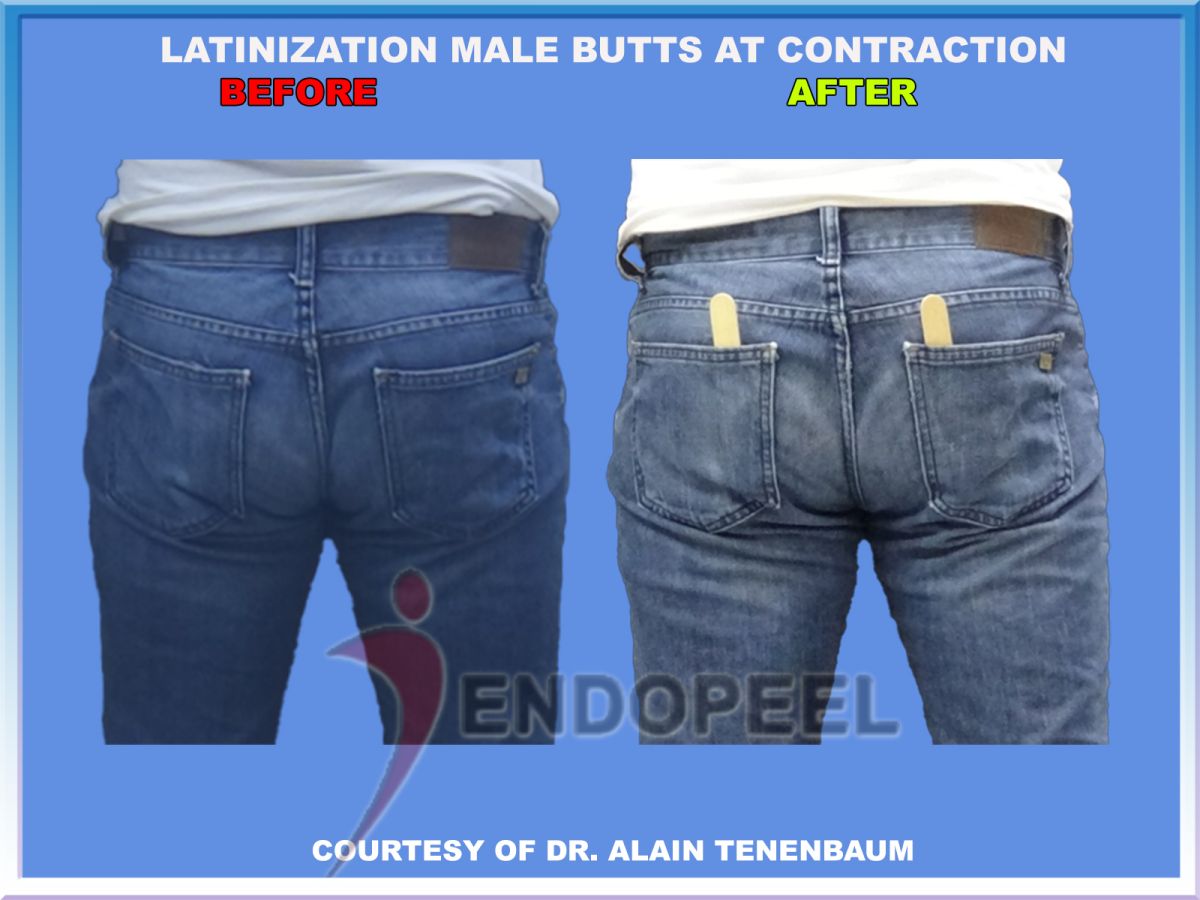  Latinization of  Male Butts at Contraction
