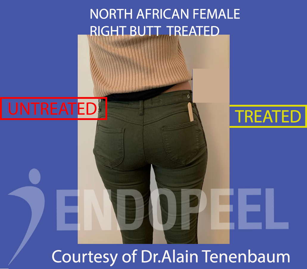 North African Right Butt Female Pants Result