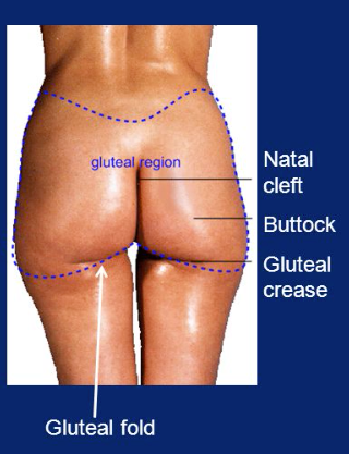 intergluteal cleft