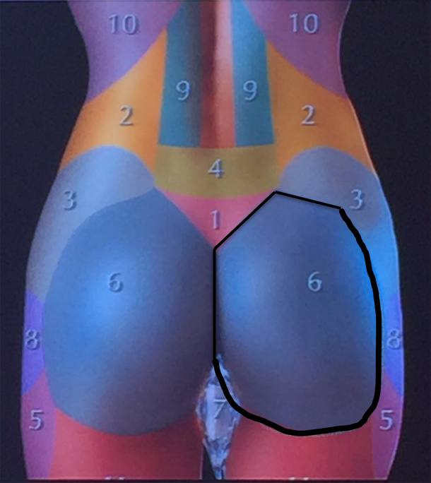 gluteal area limits in theory