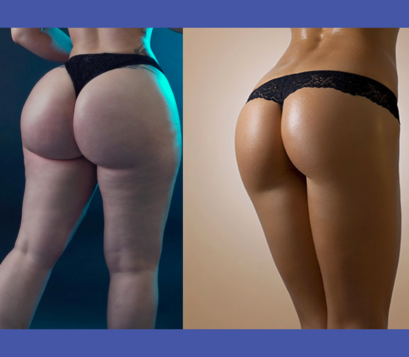 paradigm shift of latino female butts