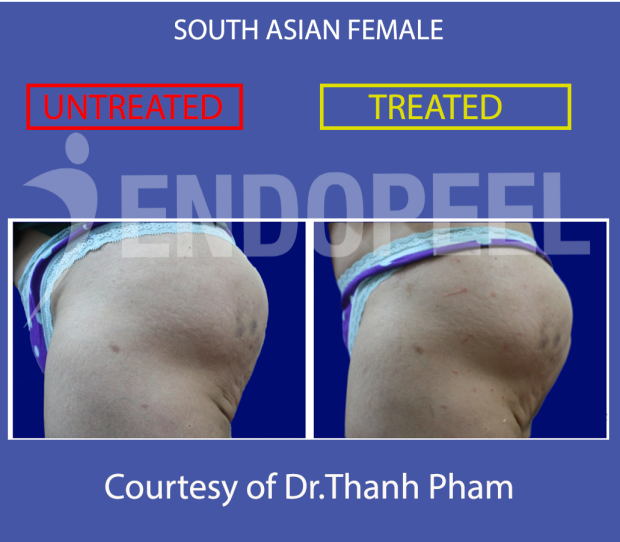 south asian female butt profile