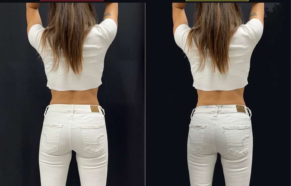 Results female butt new trends with white jeans